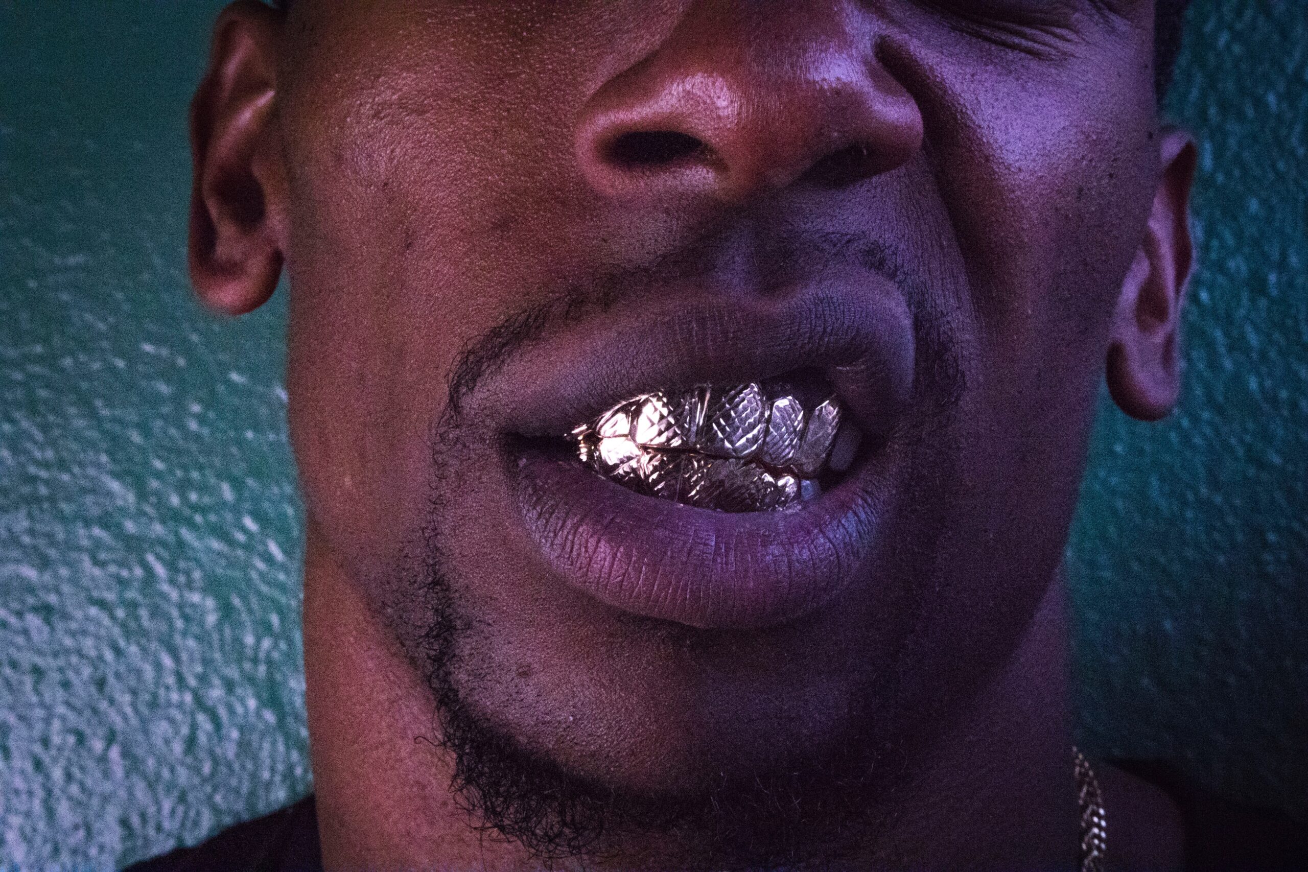 Combien coûte un grillz en diamant ?